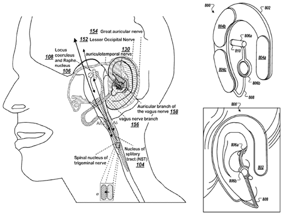 Spark-earpiece